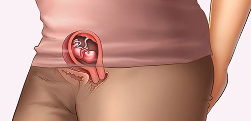 10 week pregnant 