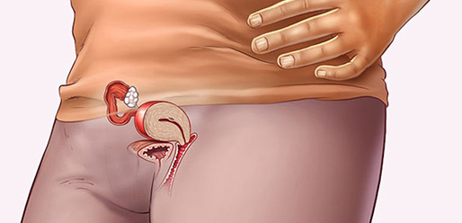 Pregnancy test