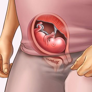 Week 15