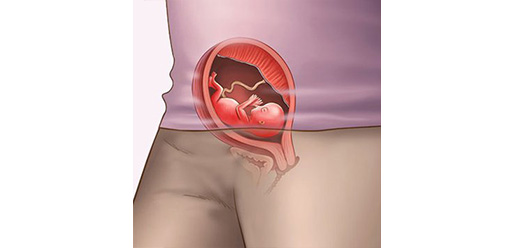14 week pregnant