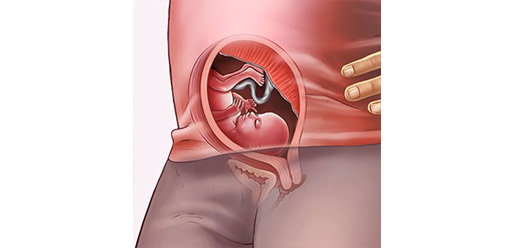 18 weeks pregnant