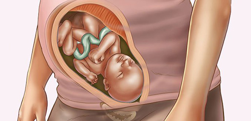 33 week pregnant 