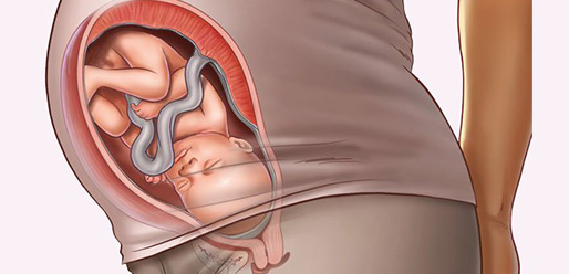 34 week pregnant