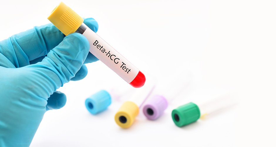 Ways To Check If You Are Successfully Pregnant Blood Tests Home Pregnancy Tests