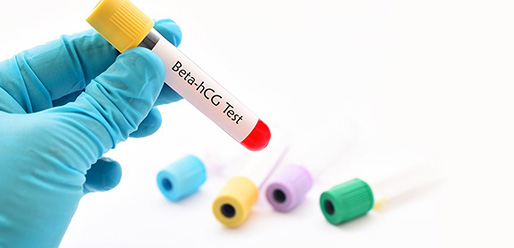 WaysToCheckIfYouAreSuccessfullyPregnantBloodTestsHomePregnancyTests